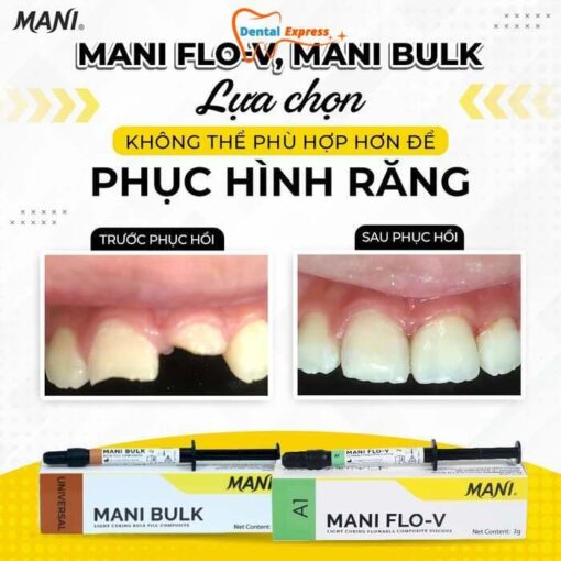 MANI FLO-V  Composite Lỏng Hàn Cổ